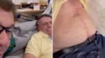 Bolsonaro mostra cicatriz abdominal ao lado de ex-ministro