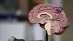 Avalie os benefícios e desvantagens do medicamento mais recente para o tratamento do Alzheimer