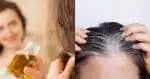 Milagre em gotas: Óleo escurece cabelo branco natural!
