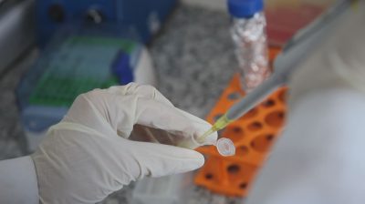 Final de década, teste de vacina contra HIV pára após maus resultados